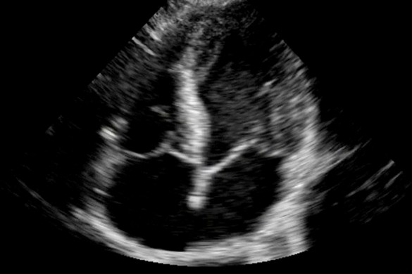 ultrasound-4d